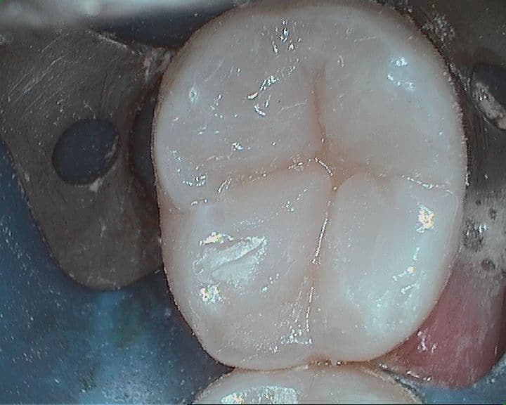 Chrysanthemum P 18 Deep Decay After