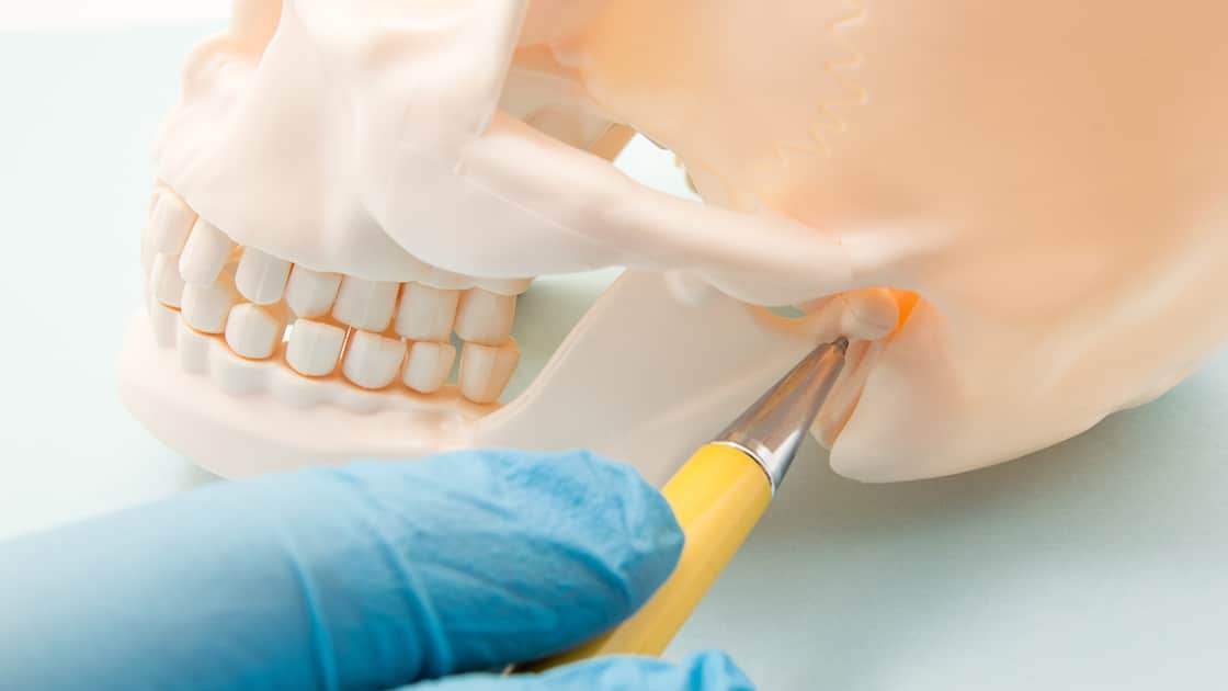 TMJ Disorders - Model of Jaw showing TMJ joint location